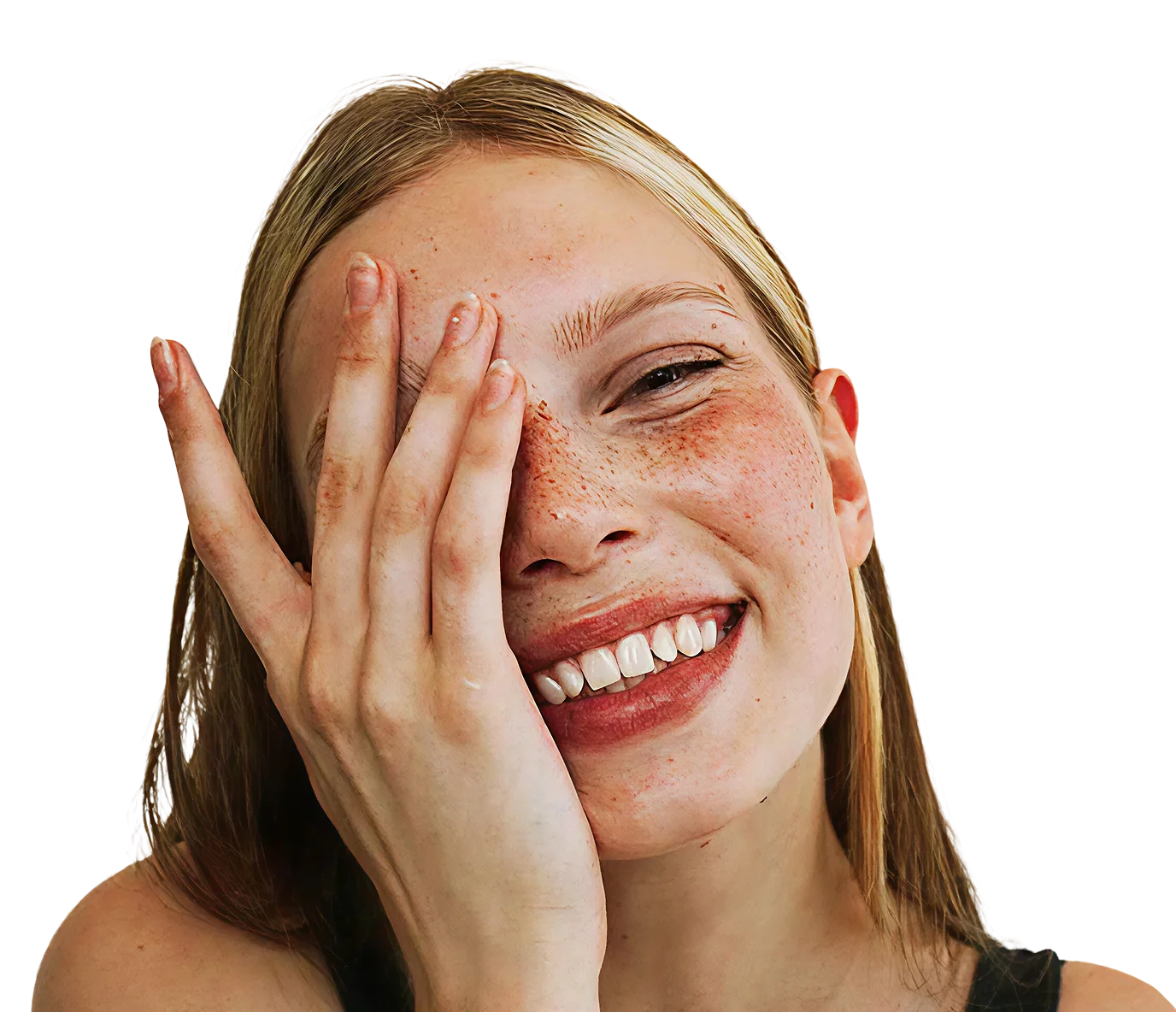 Улыбающаяся пациентка Smile Gallery