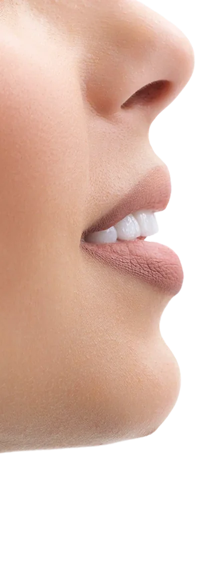 Улыбка пациентки клиники Smile Gallery